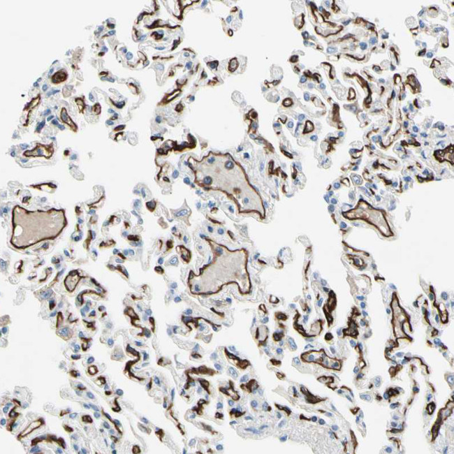 CD93 Antibody in Immunohistochemistry (IHC)