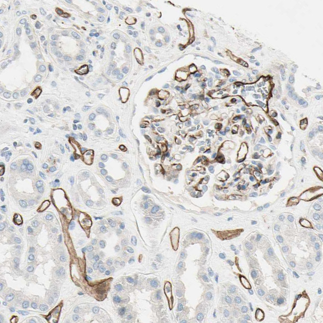 CD93 Antibody in Immunohistochemistry (IHC)