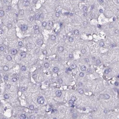 DPEP1 Antibody in Immunohistochemistry (IHC)