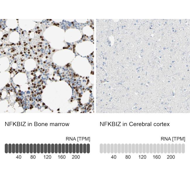 IkB zeta Antibody in Immunohistochemistry (IHC)