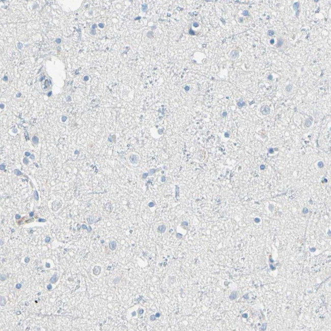 IkB zeta Antibody in Immunohistochemistry (IHC)