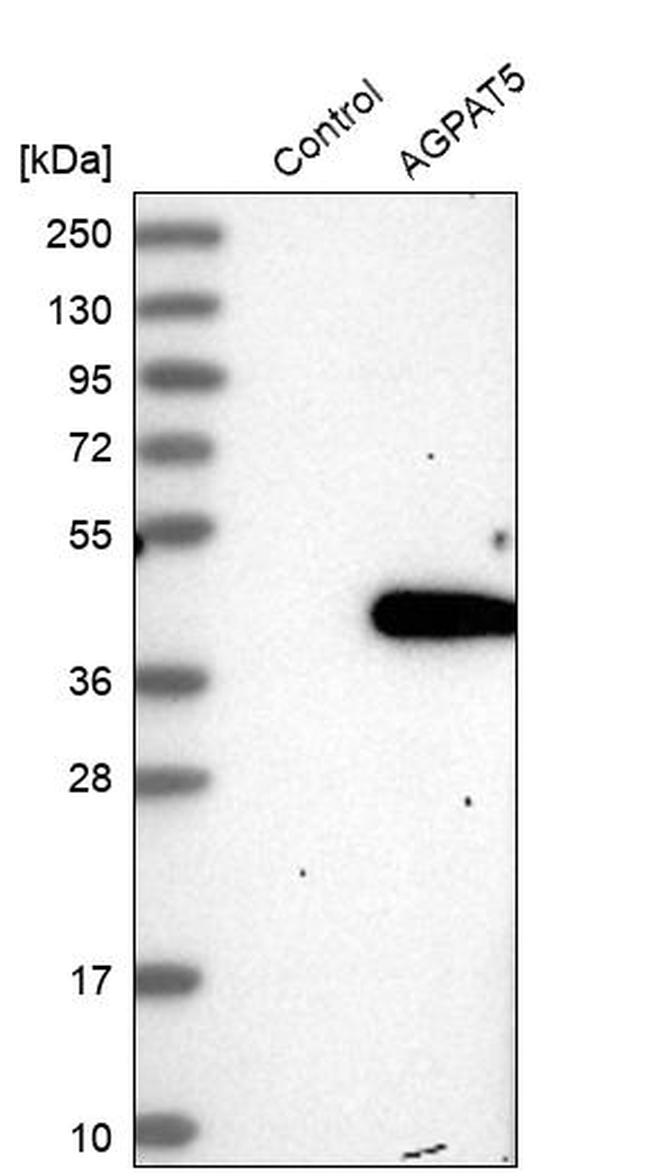 AGPAT5 Antibody in Western Blot (WB)