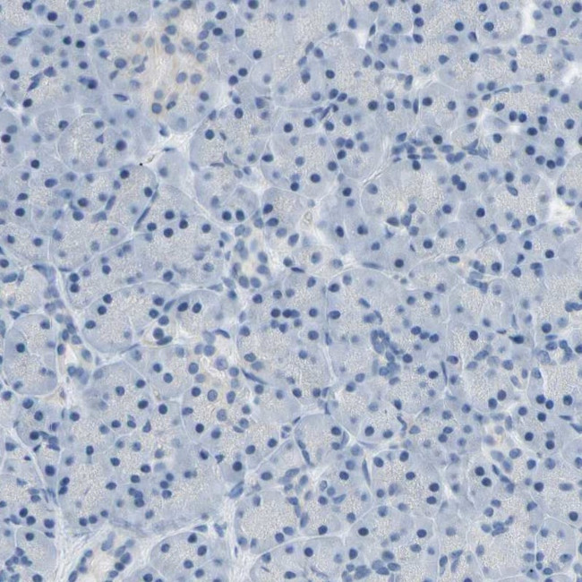 ATP1B2 Antibody in Immunohistochemistry (IHC)