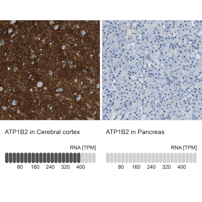 ATP1B2 Antibody