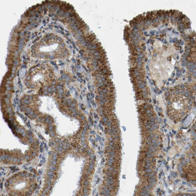 TRAP alpha Antibody in Immunohistochemistry (IHC)