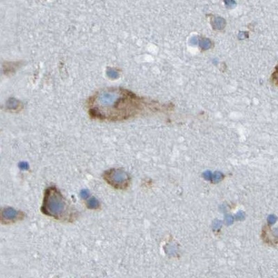 TRAP alpha Antibody in Immunohistochemistry (IHC)