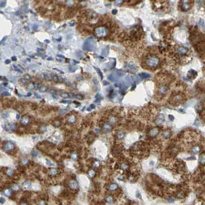 TRAP alpha Antibody in Immunohistochemistry (IHC)