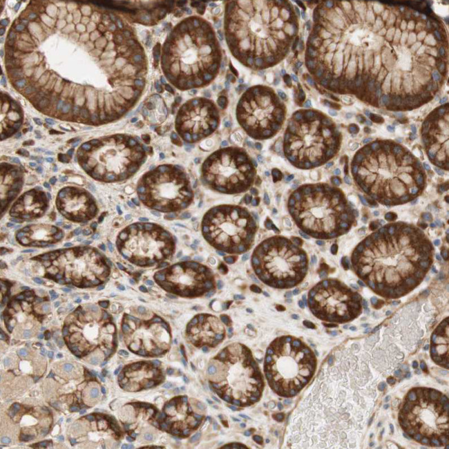 Stomatin Antibody in Immunohistochemistry (IHC)