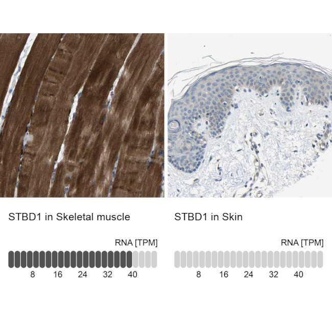 STBD1 Antibody in Immunohistochemistry (IHC)
