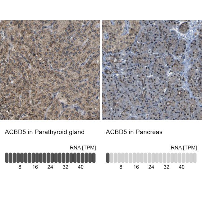 ACBD5 Antibody in Immunohistochemistry (IHC)