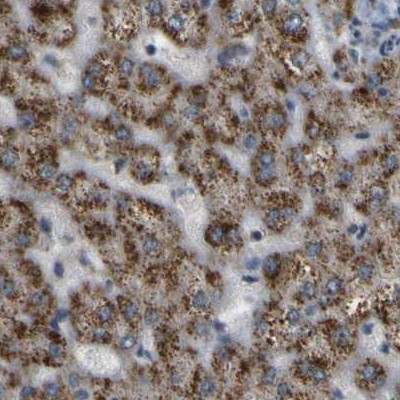 ACBD5 Antibody in Immunohistochemistry (IHC)