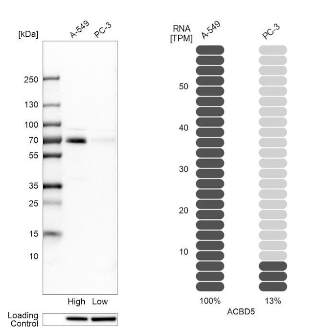 ACBD5 Antibody