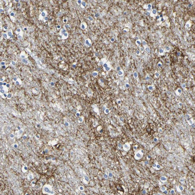 OTOF Antibody in Immunohistochemistry (IHC)