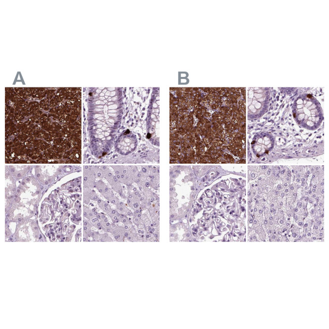 Chromogranin B Antibody in Immunohistochemistry (IHC)