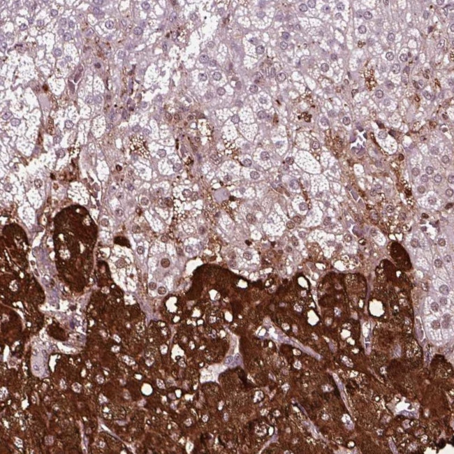 Chromogranin B Antibody in Immunohistochemistry (IHC)