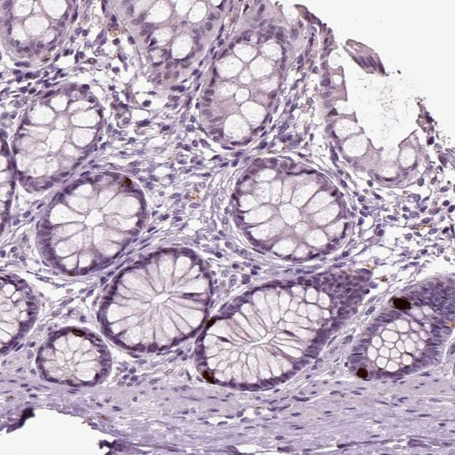 Chromogranin B Antibody in Immunohistochemistry (IHC)