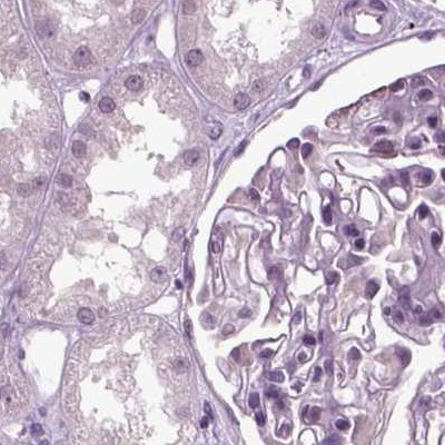 Chromogranin B Antibody in Immunohistochemistry (IHC)