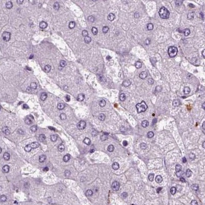 Chromogranin B Antibody in Immunohistochemistry (IHC)