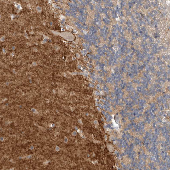 NRCAM Antibody in Immunohistochemistry (IHC)