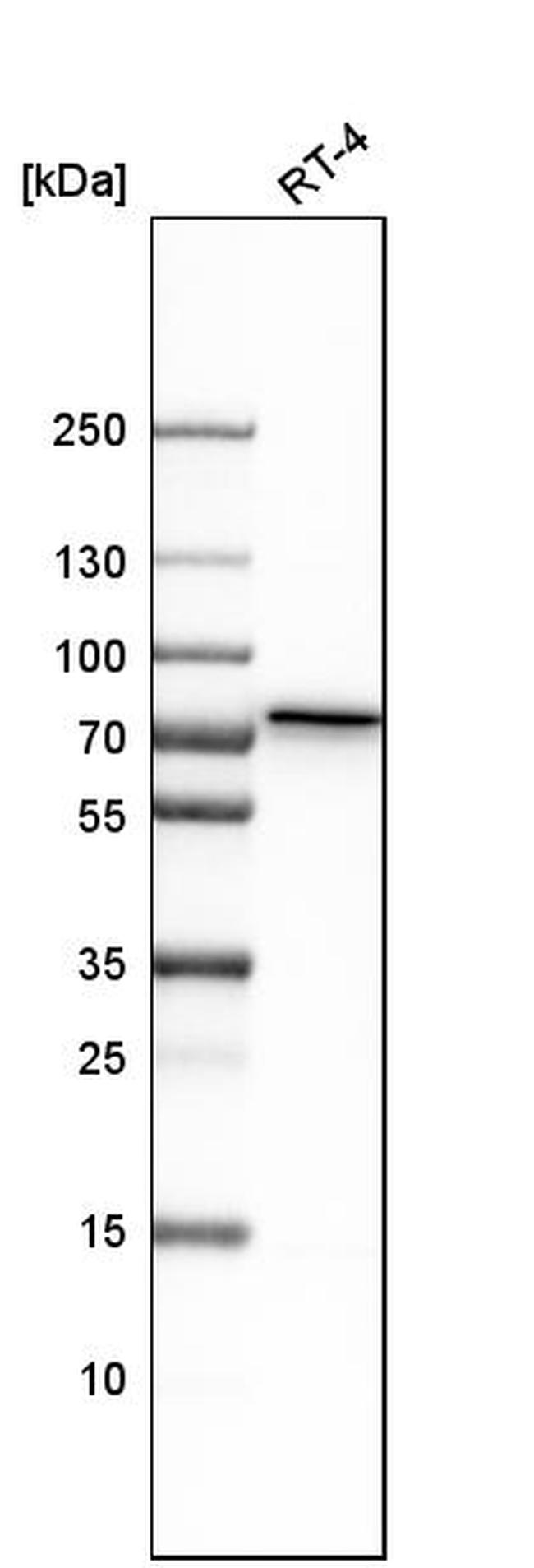 GALNT1 Antibody in Western Blot (WB)