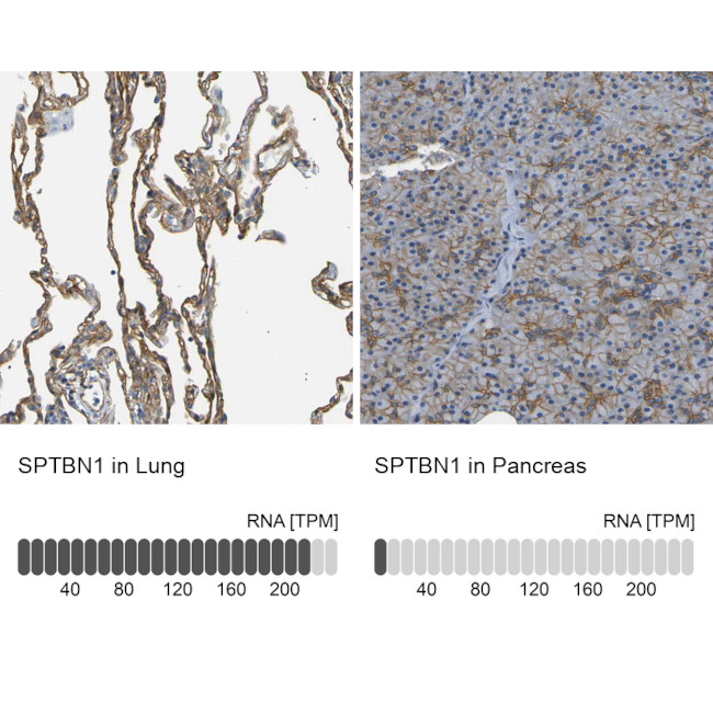 SPTBN1 Antibody in Immunohistochemistry (IHC)
