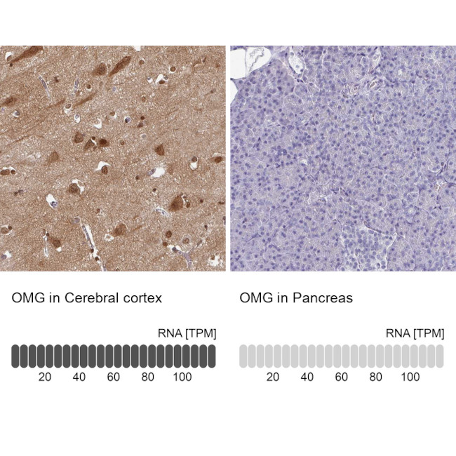 OMG Antibody in Immunohistochemistry (IHC)