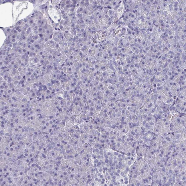 OMG Antibody in Immunohistochemistry (IHC)