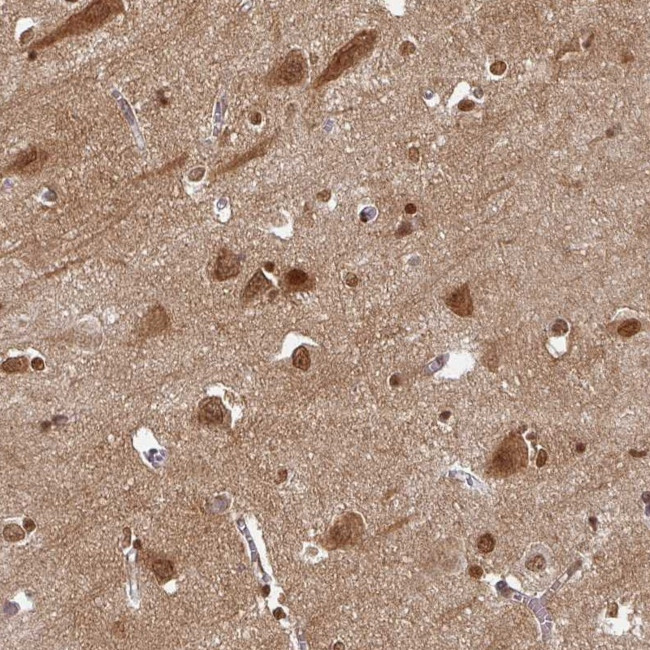 OMG Antibody in Immunohistochemistry (IHC)