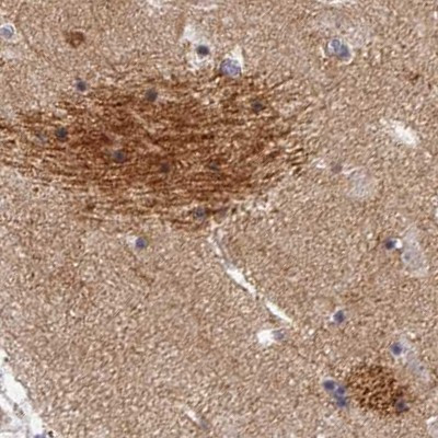 OMG Antibody in Immunohistochemistry (IHC)