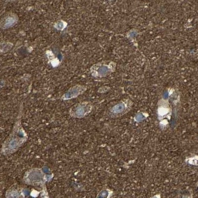 C1GALT1 Antibody in Immunohistochemistry (IHC)