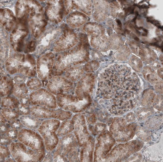 KANK4 Antibody in Immunohistochemistry (IHC)