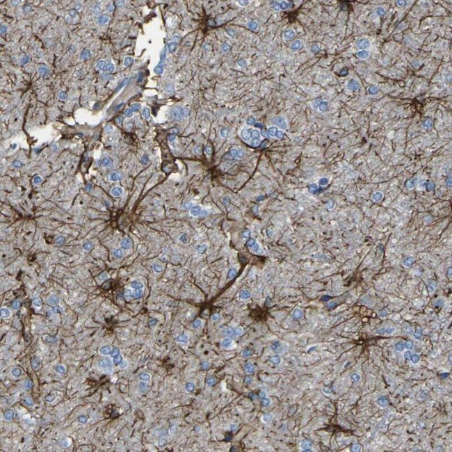 KLHDC8B Antibody in Immunohistochemistry (IHC)