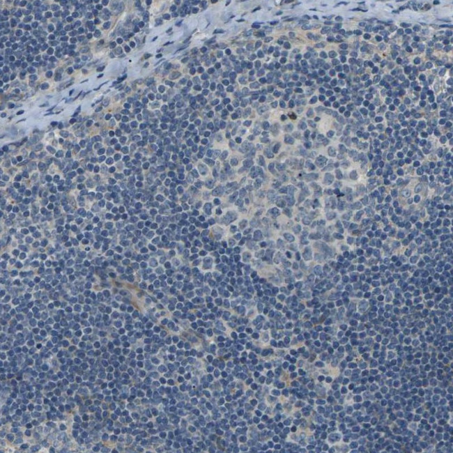 SLC13A3 Antibody in Immunohistochemistry (IHC)