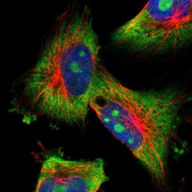 KV3.4 (KCNC4) Antibody in Immunocytochemistry (ICC/IF)