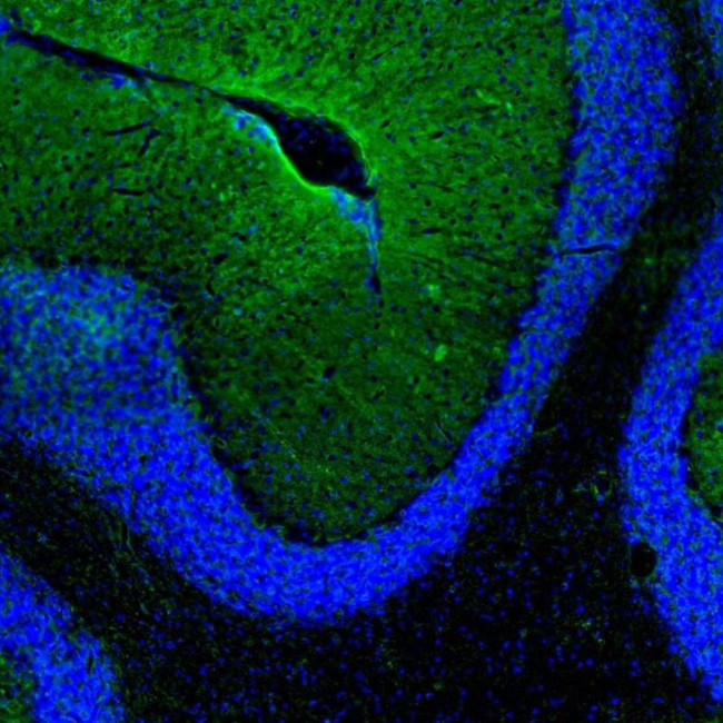 Aquaporin 4 Antibody in Immunocytochemistry (ICC/IF)