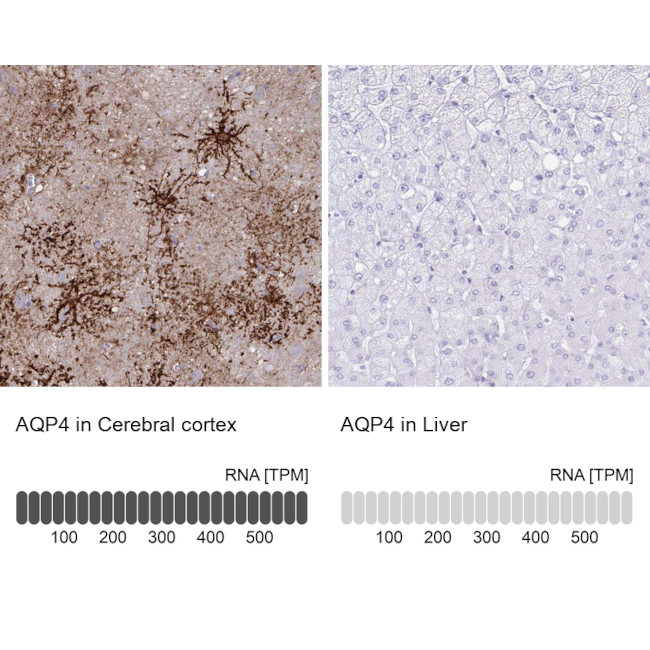 Aquaporin 4 Antibody in Immunohistochemistry (IHC)