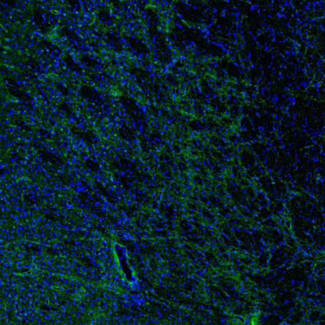 Aquaporin 4 Antibody in Immunohistochemistry (IHC)