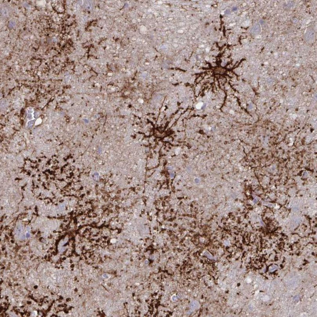 Aquaporin 4 Antibody in Immunohistochemistry (IHC)