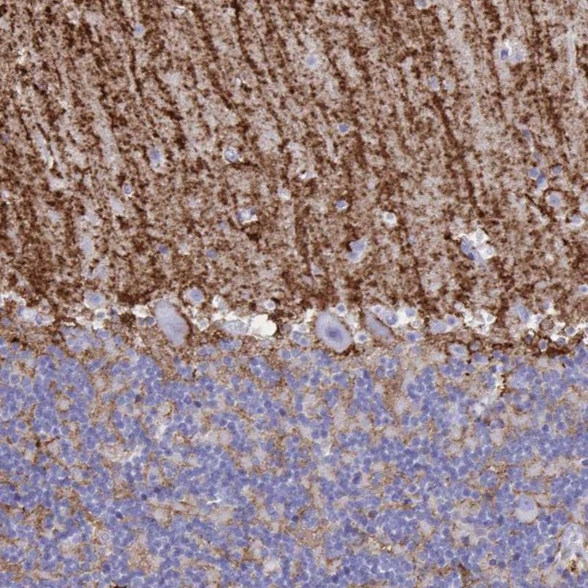 Aquaporin 4 Antibody in Immunohistochemistry (IHC)