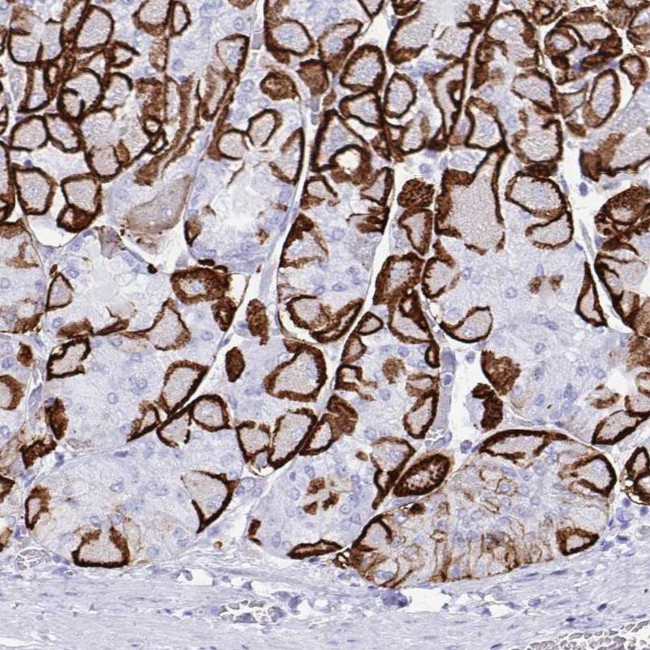 Aquaporin 4 Antibody in Immunohistochemistry (IHC)