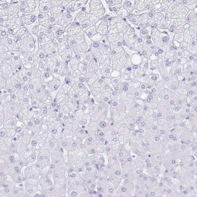 Aquaporin 4 Antibody in Immunohistochemistry (IHC)