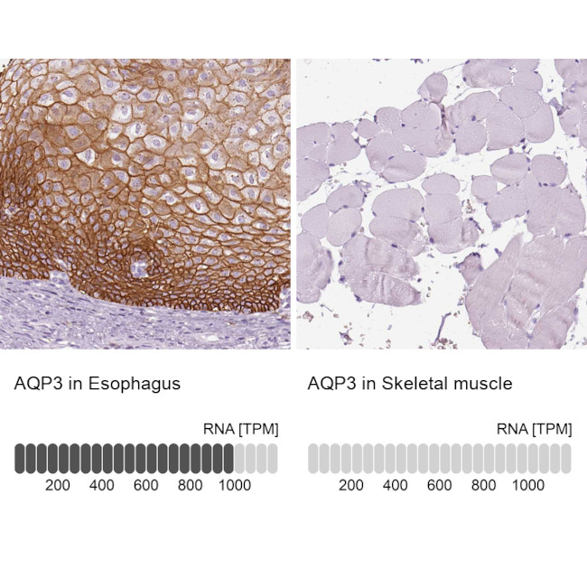 Aquaporin 3 Antibody in Immunohistochemistry (IHC)