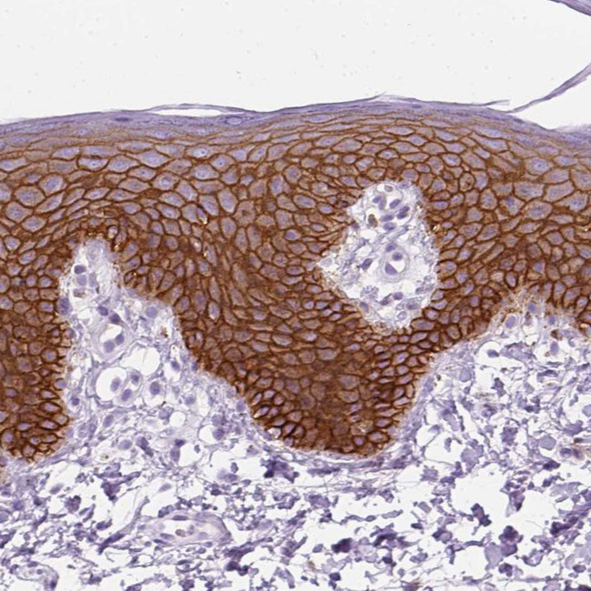 Aquaporin 3 Antibody in Immunohistochemistry (IHC)