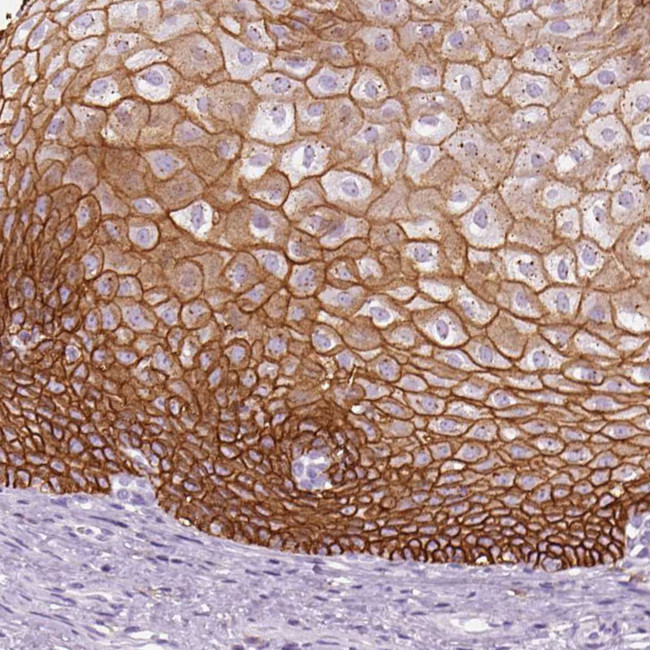 Aquaporin 3 Antibody in Immunohistochemistry (IHC)