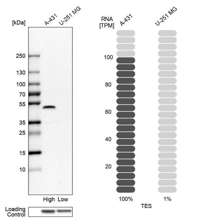 TES Antibody in Western Blot (WB)