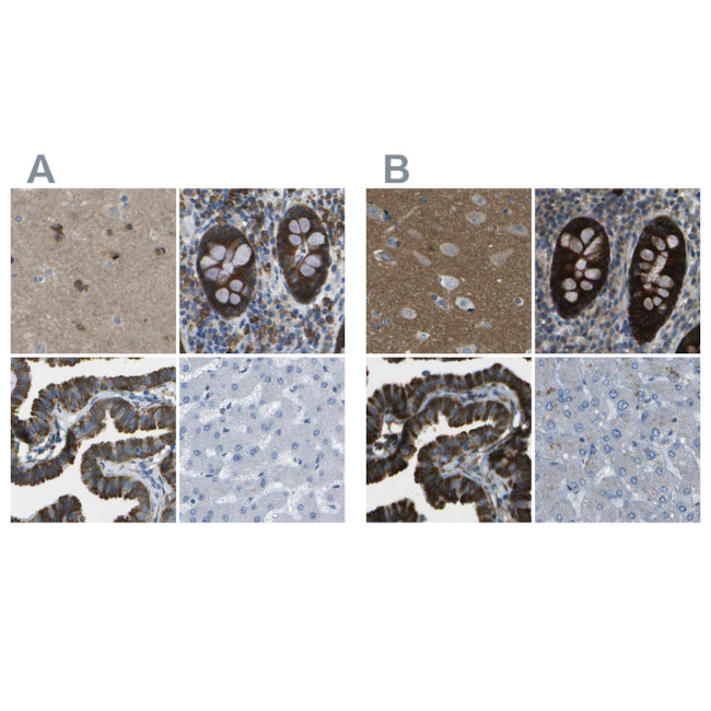 WNK2 Antibody in Immunohistochemistry (IHC)