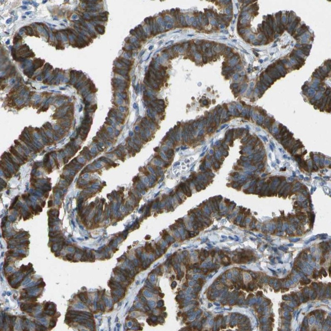 WNK2 Antibody in Immunohistochemistry (IHC)