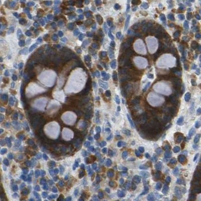 WNK2 Antibody in Immunohistochemistry (IHC)