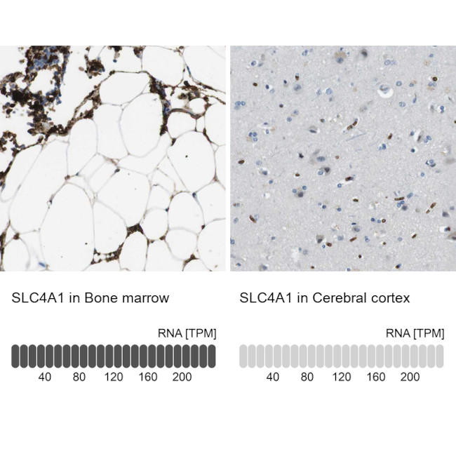 SLC4A1 Antibody in Immunohistochemistry (IHC)