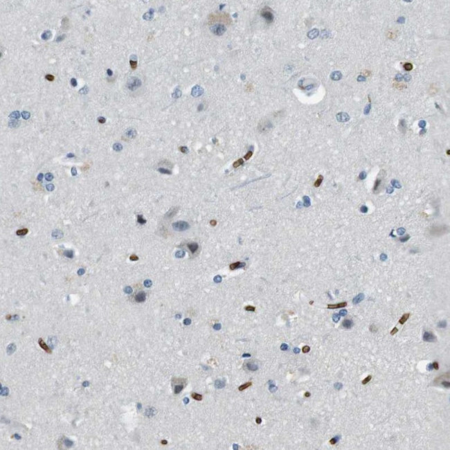 SLC4A1 Antibody in Immunohistochemistry (IHC)